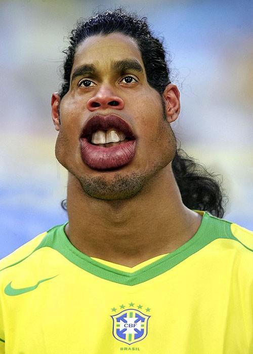 Ronaldinho hay vẫn thường được người hâm mộ yêu mến gọi với biệt danh ‘Rô vẩu’.